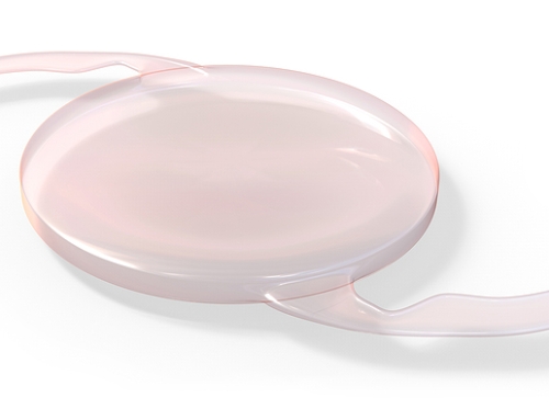 Refractive Lens Exchange: A Solution for Presbyopia and Vision Correction